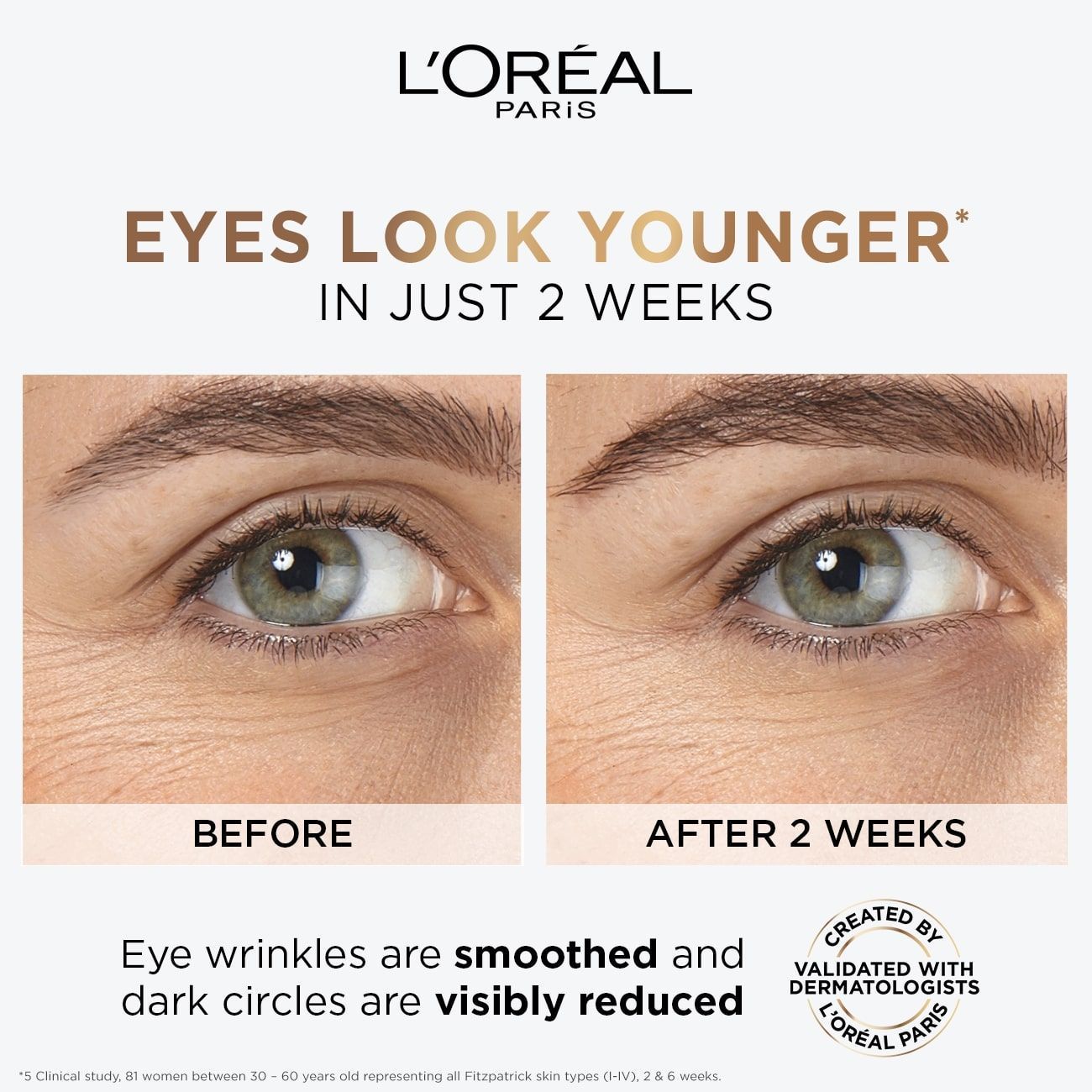L'Oreal Hyaluron Expert Eye Serum, 20ml - Makkah Pharmacy