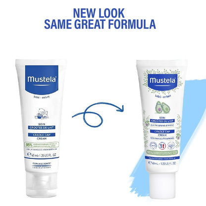 Mustela Cradle Cap Moisturizing & Softening Scalp Cream for Babies (0+ Months), 40ml - Makkah Pharmacy