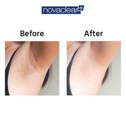 Novaclear Whitening Armpit Roll On, 50ml - Makkah Pharmacy