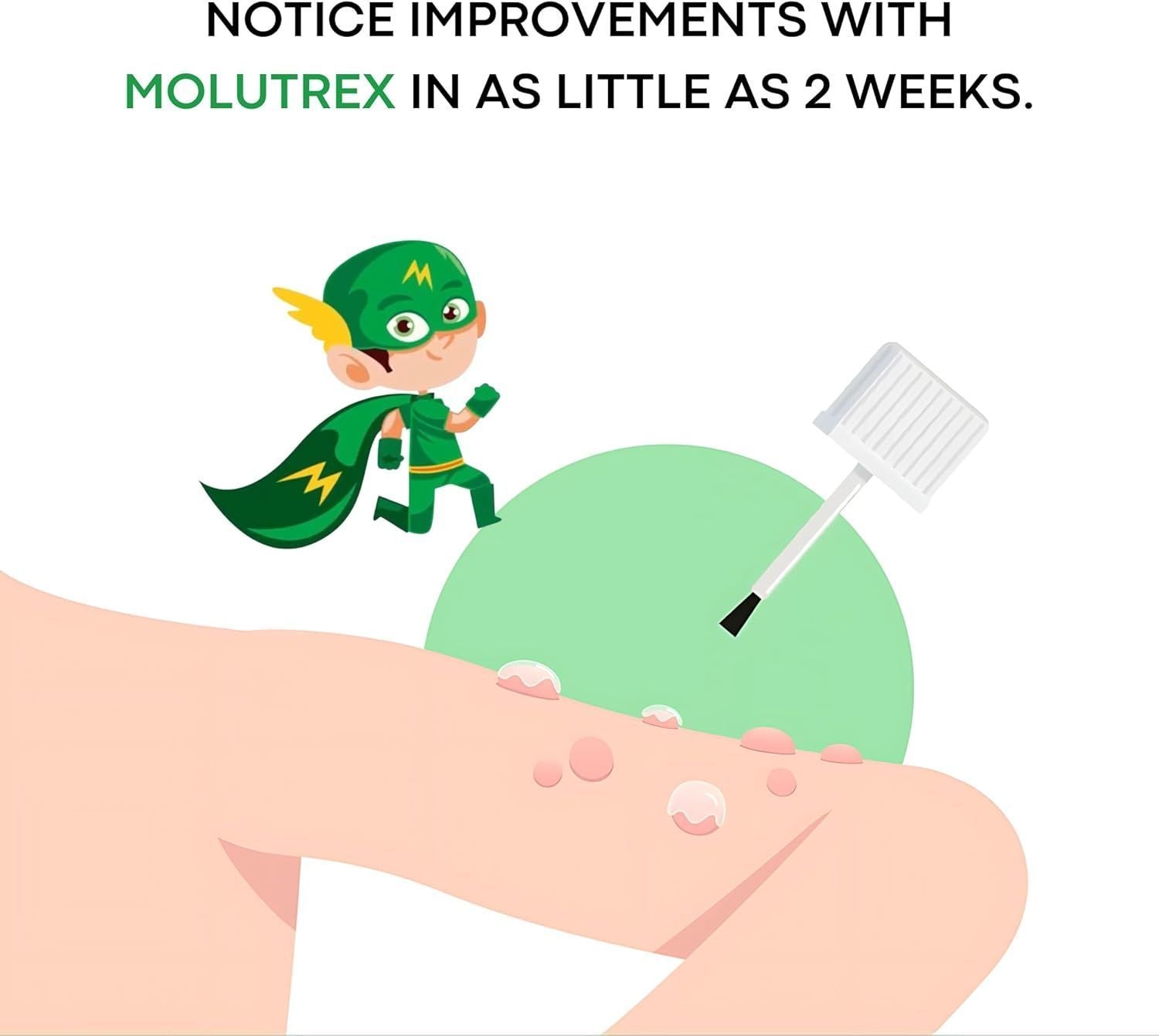 Acm Molutrex 5% Potassium Hydroxide, 3ml - Makkah Pharmacy