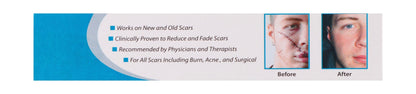 Newgel+ E Advanced Silicone Gel for Scars, 15g - Makkah Pharmacy